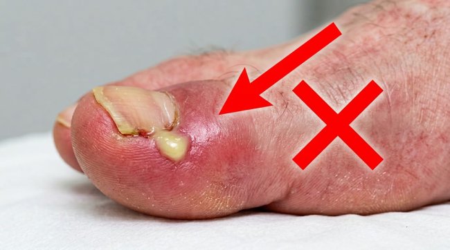 ����� Combiped: ����������� ������ ���������